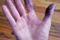 cara praktis menghilangkan noda cat pada kulit tubuh cara menghilangkan noda cat di kulit tangan